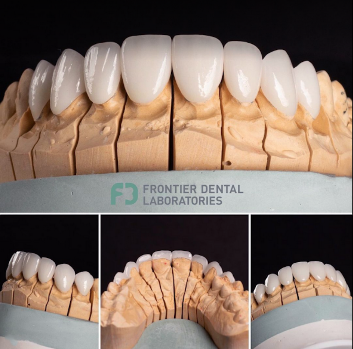 Frontier Dental Laboratories photo 1