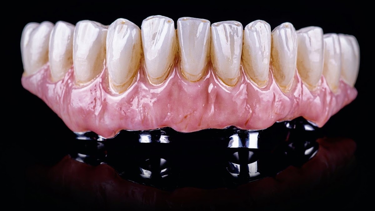 Frontier Dental Laboratories photo 2