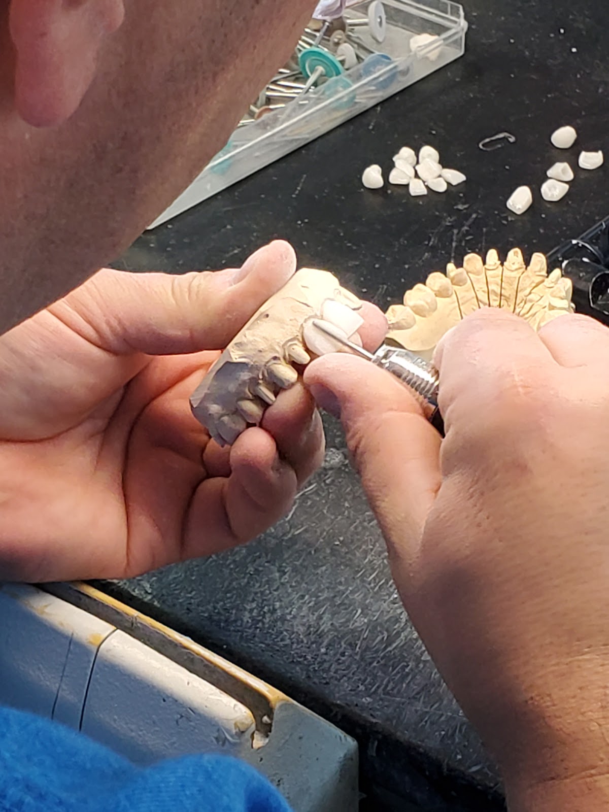 Frontier Dental Laboratories photo 4