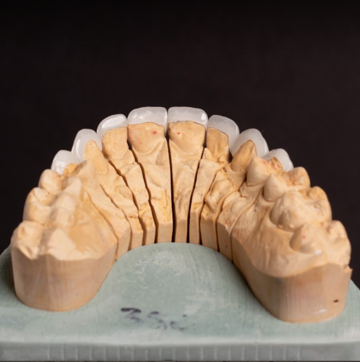 Frontier Dental Laboratories photo 6