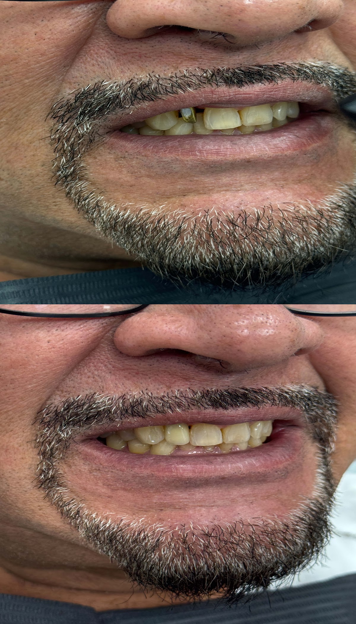 Flossy Smiles Dental Implants & Aesthetics photo 4