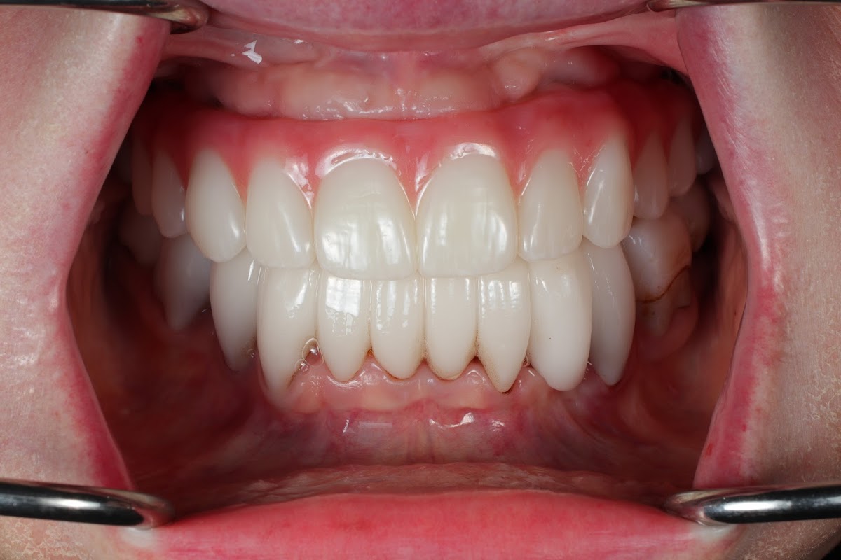 Dental Implant Docs photo 1