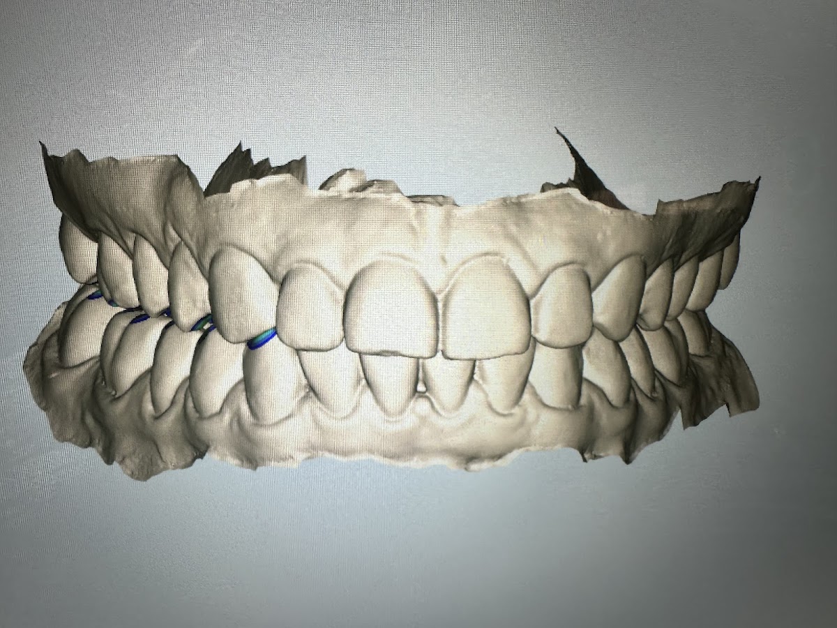 Boca Raton Cosmetic Dentist - Dr. Sasha Winderbaum photo 6