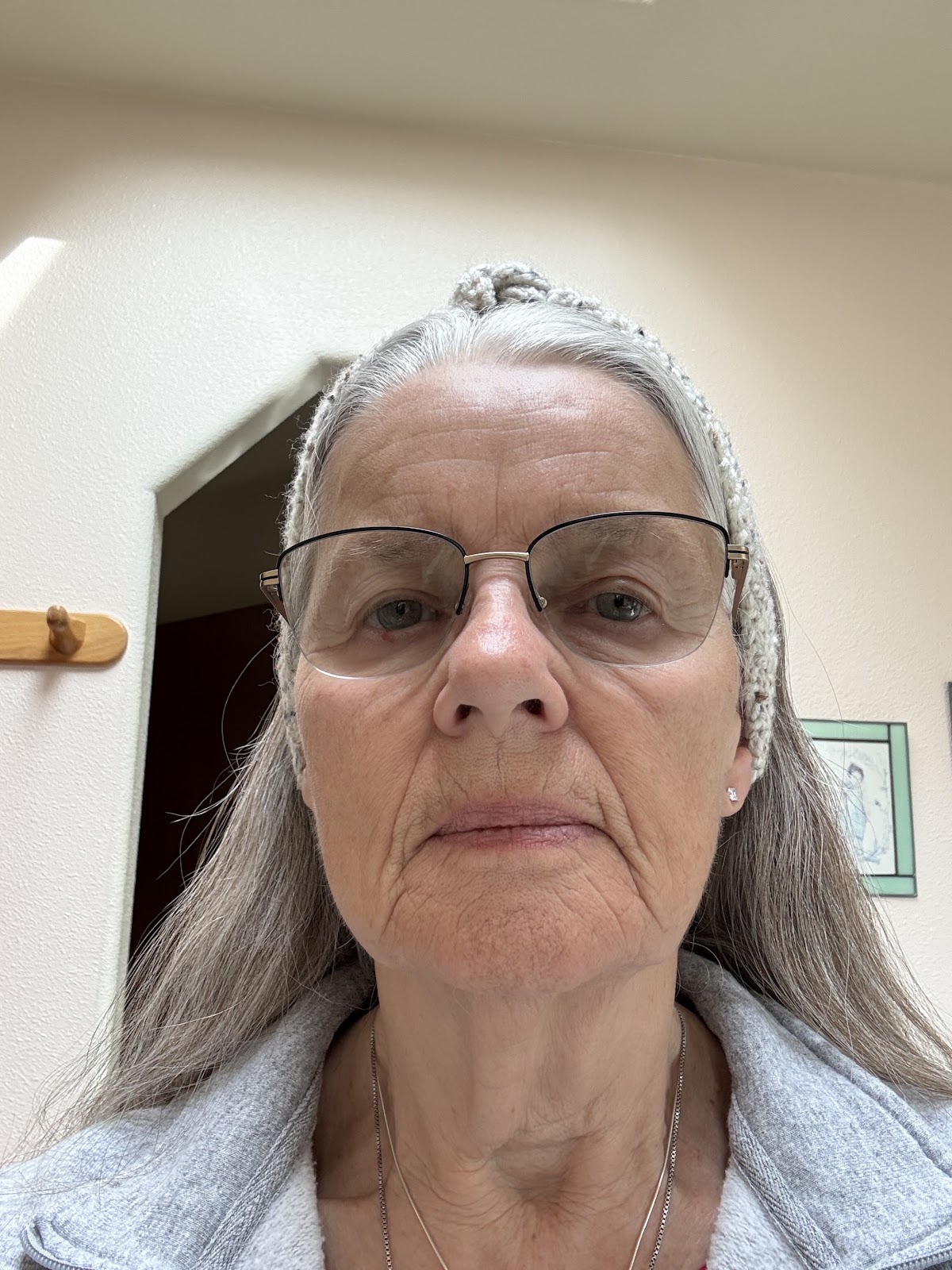 Bluebird Oral Surgery photo 3