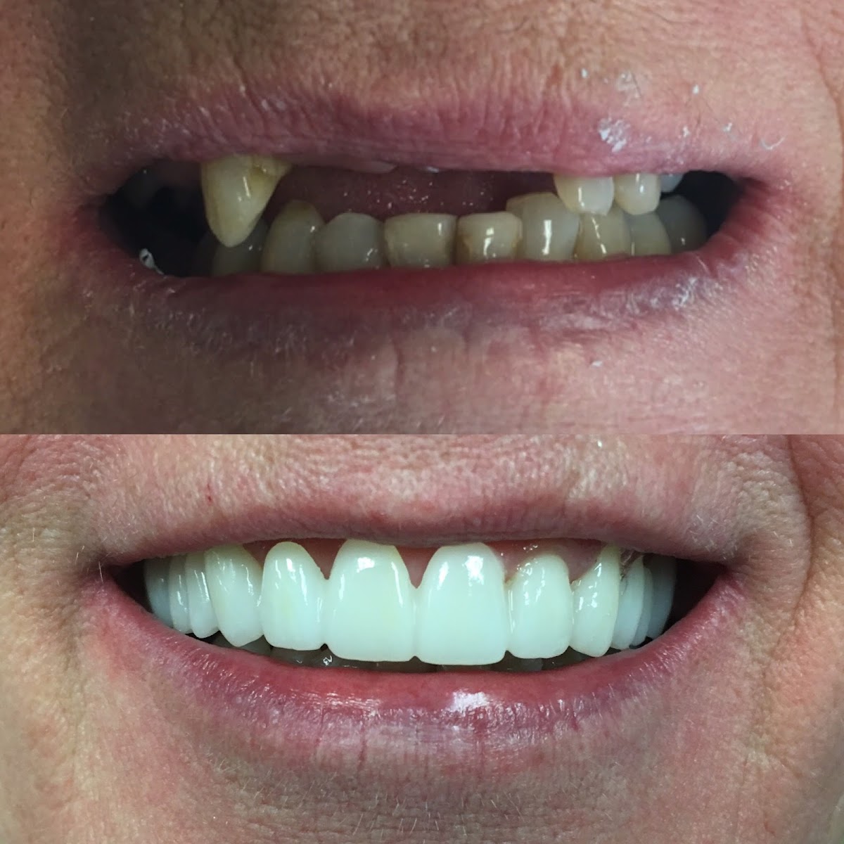 Infinity Dental: Cosmetic, Sedation, Surgical, and Implant Dentistry; Dr Gary S Bhatti DDS photo 3