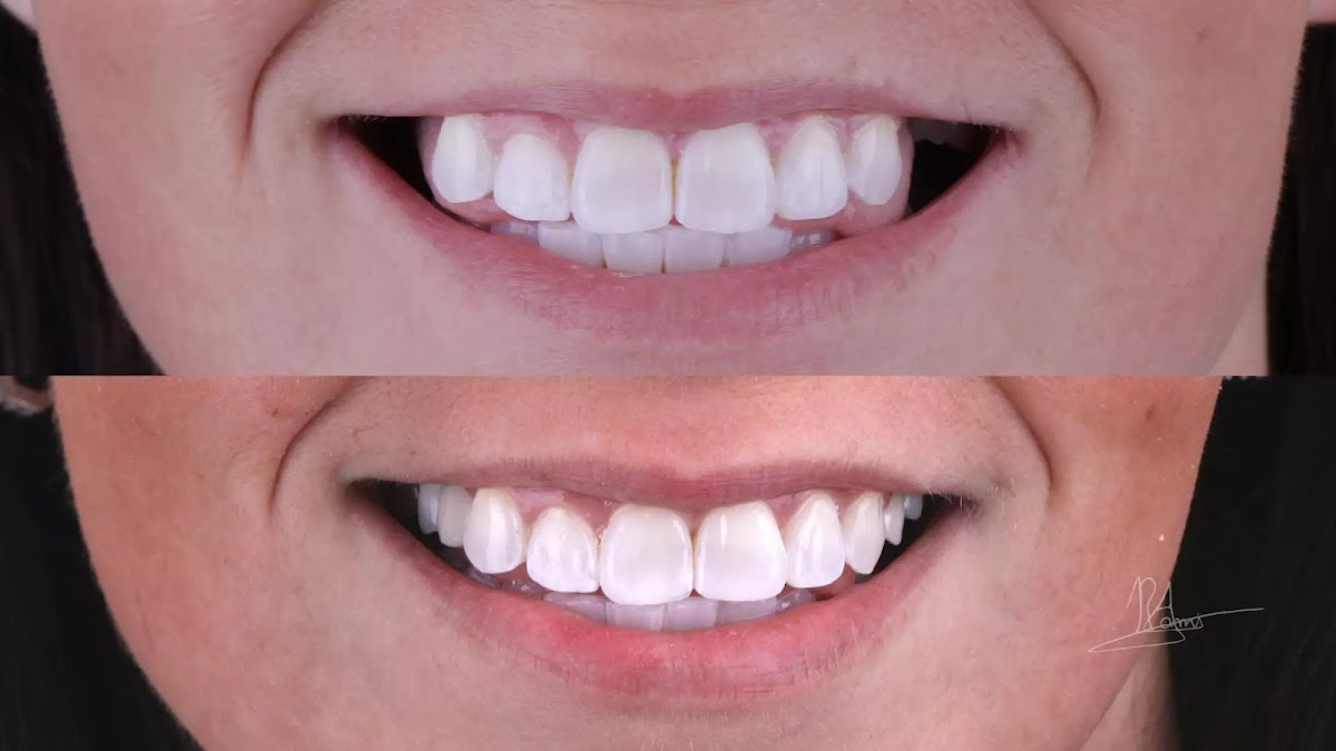 Richmond Implant & Smile Studio photo 5