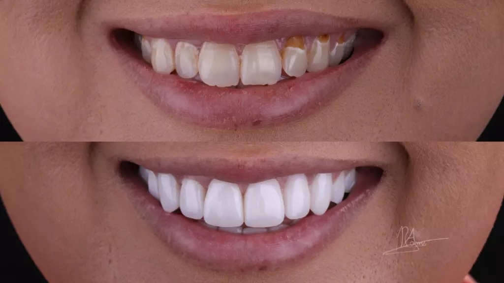 Richmond Implant & Smile Studio photo 6