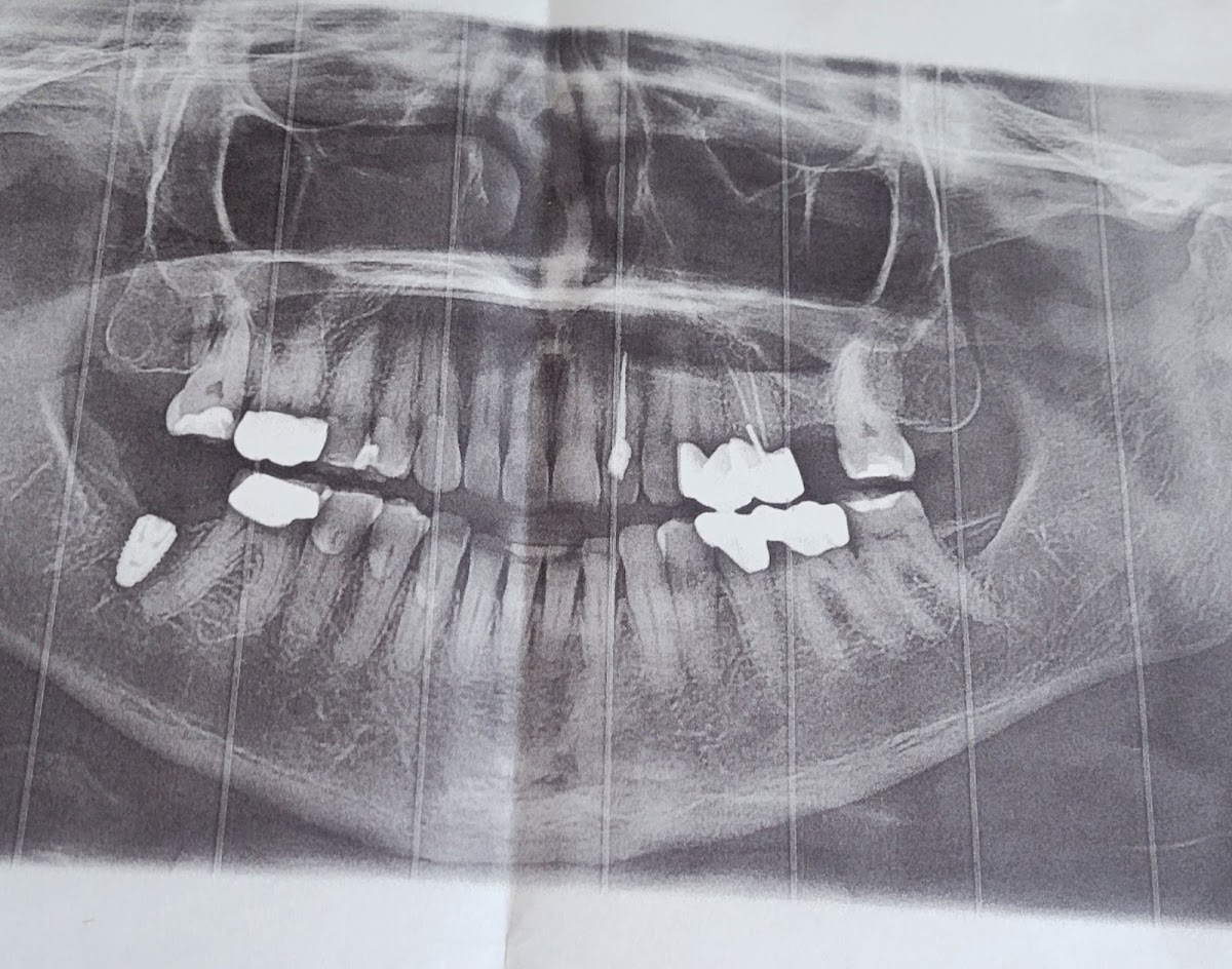 Bird and Johnson, Oral Surgery photo 5