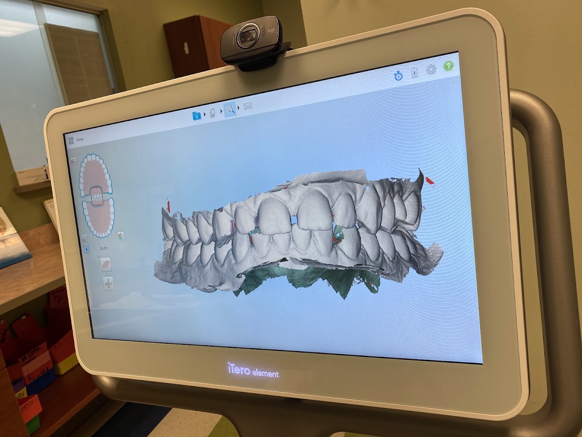 Aspen Dental - Strongsville photo 3