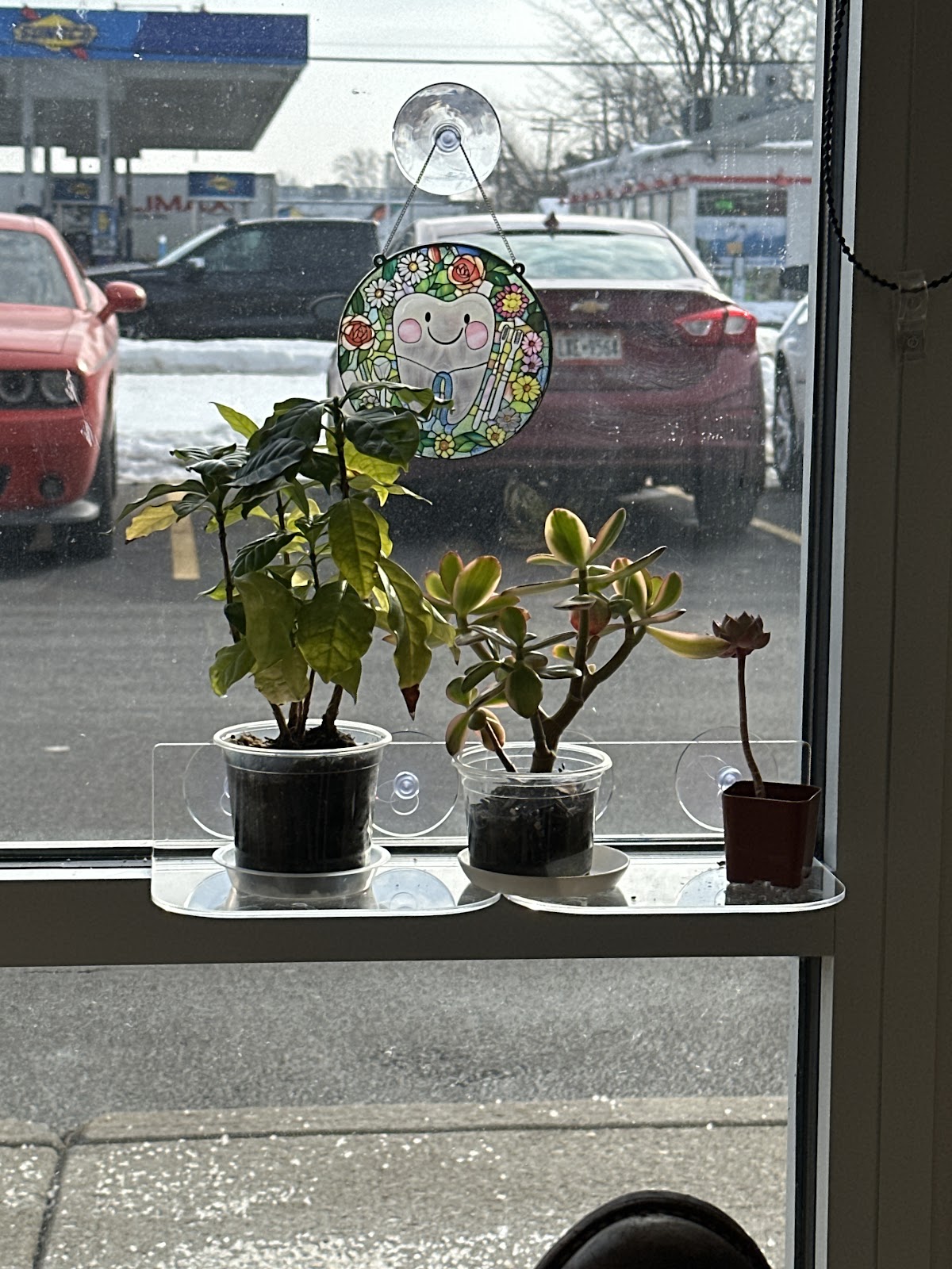 Aspen Dental - Tonawanda photo 6