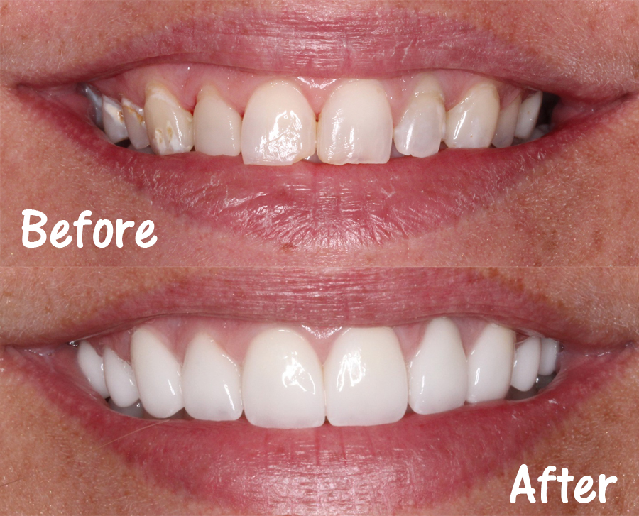 The Center for Cosmetic Dentistry-panama City Beach photo 3