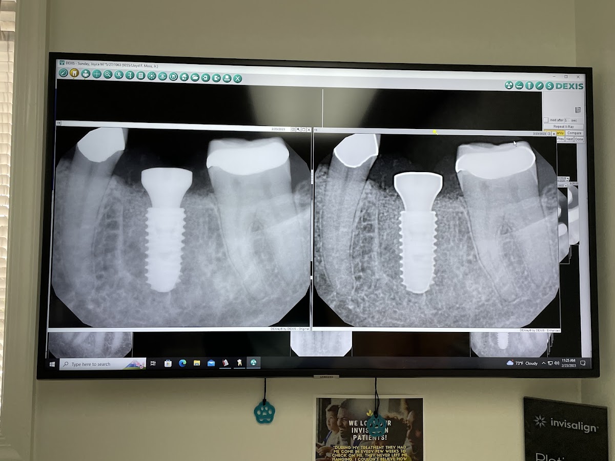 Moss Family Dentistry photo 5