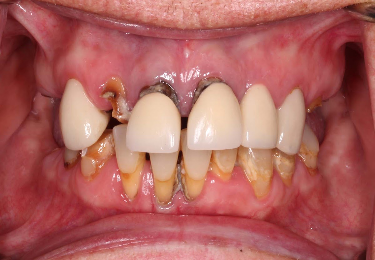 Pine Ridge Dental photo 6