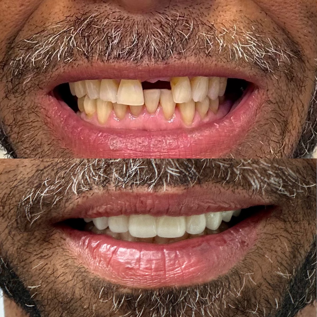 Creekside Oral Surgery and Dental Implants photo 6