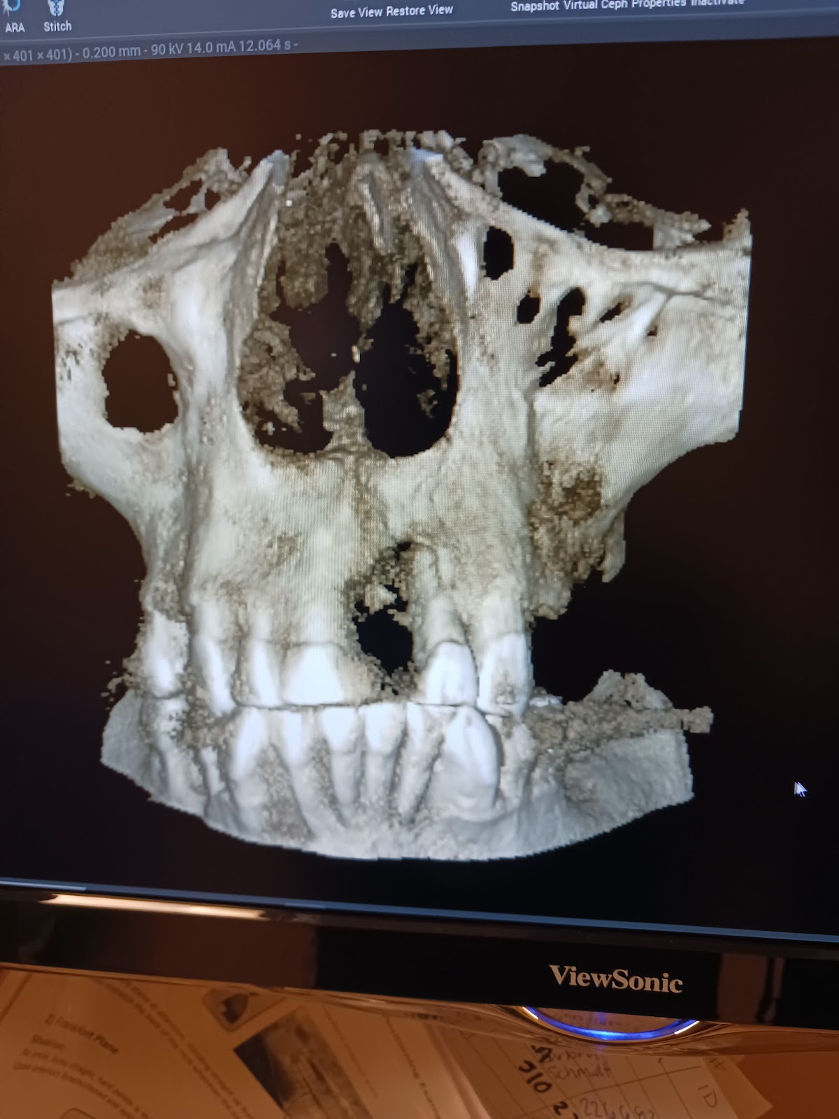 Southeast Oral Surgery & Implant Center photo 1