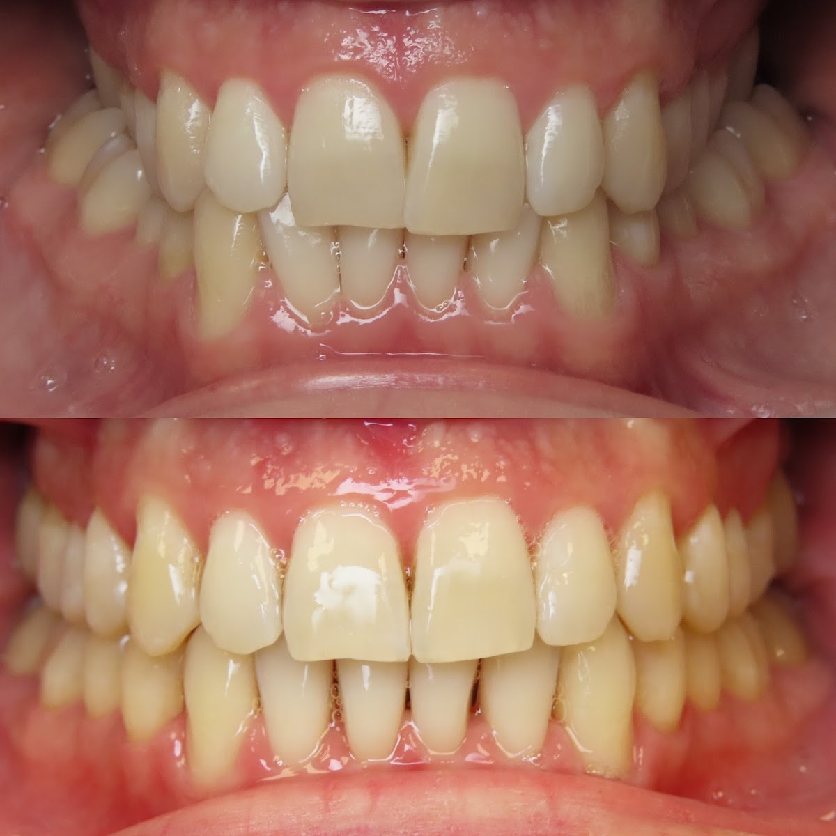 Renew Dental Denture and Implant Center photo 2