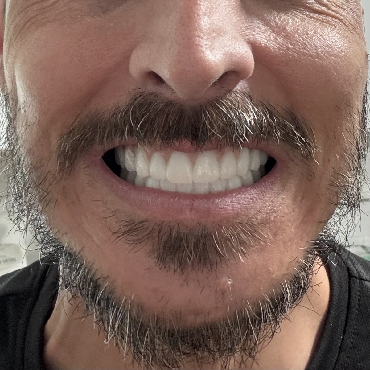 Renew Dental Denture and Implant Center photo 5