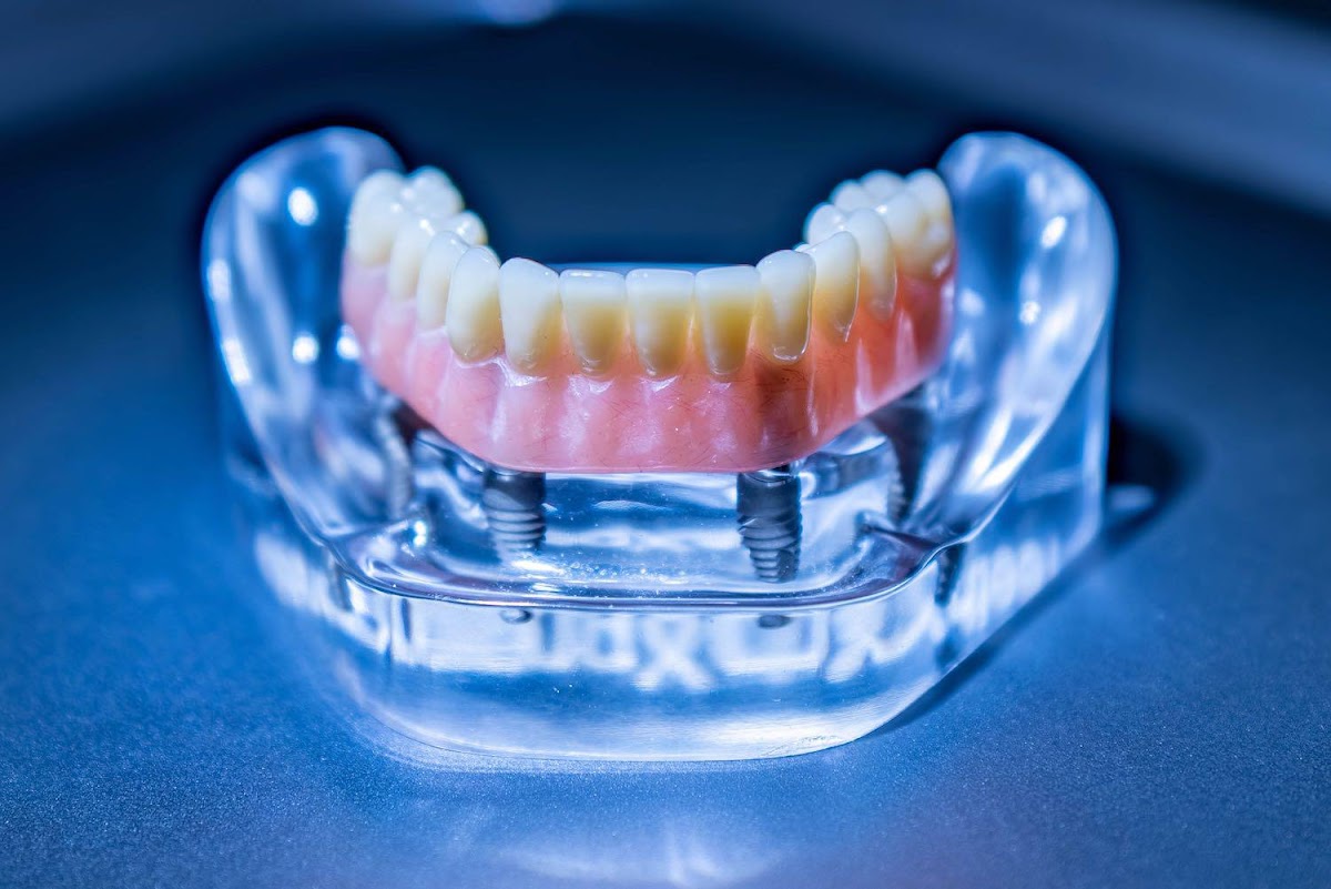 Oral and Facial Surgery Associates, LLC photo 4