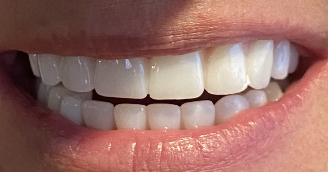 Prescott Dentures and Implants photo 6