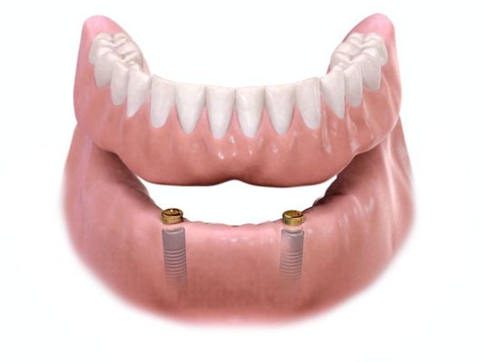 Whitlow Dental Care - Dental Implant Center photo 3