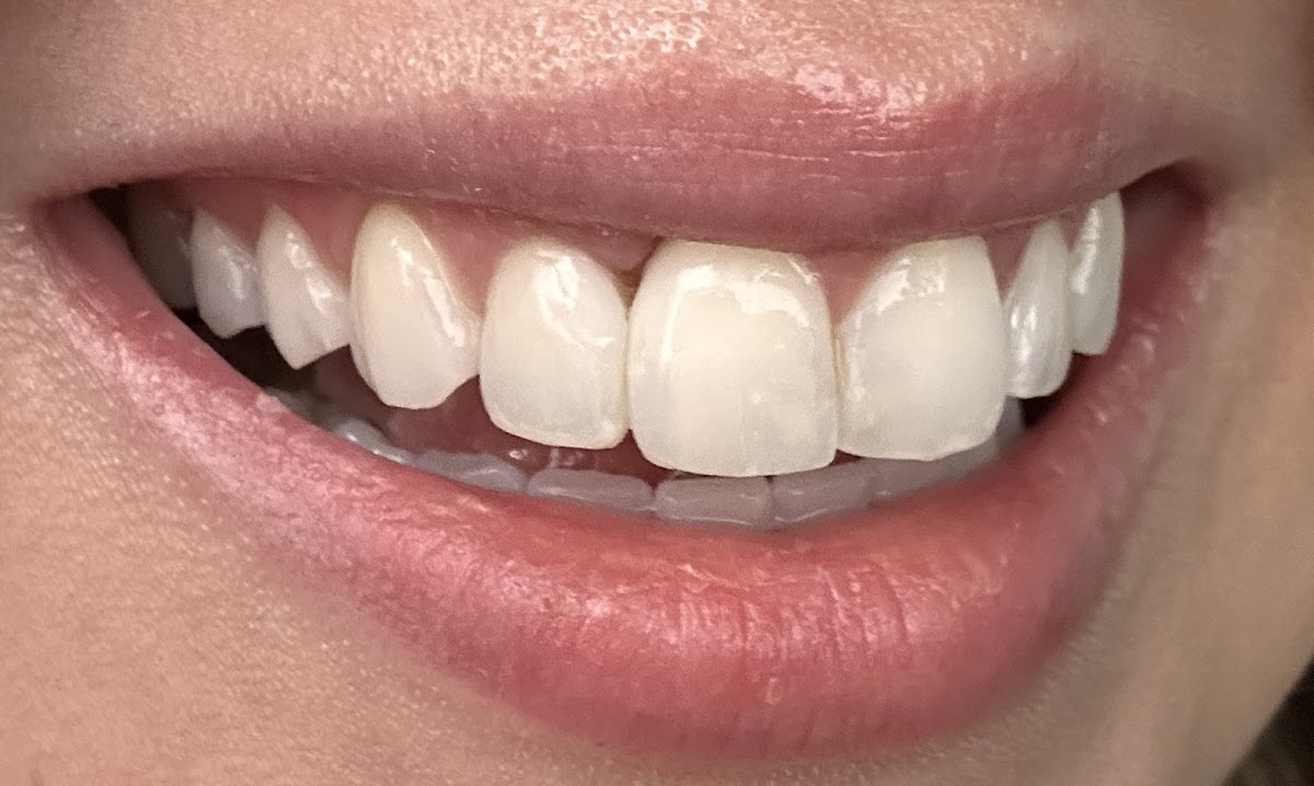 Esthetic Dentistry Pittsburgh photo 2