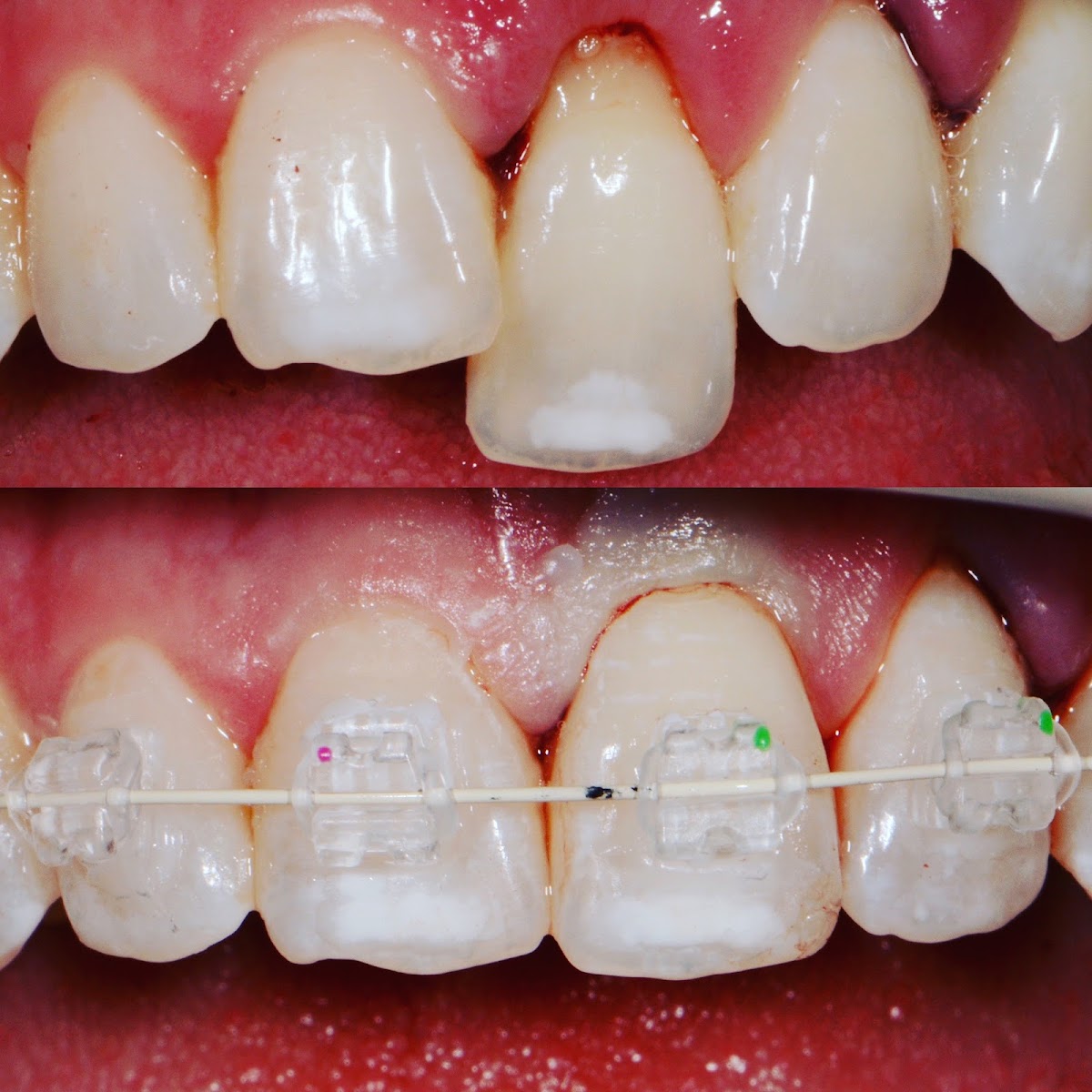 Esthetic Dentistry Pittsburgh photo 3