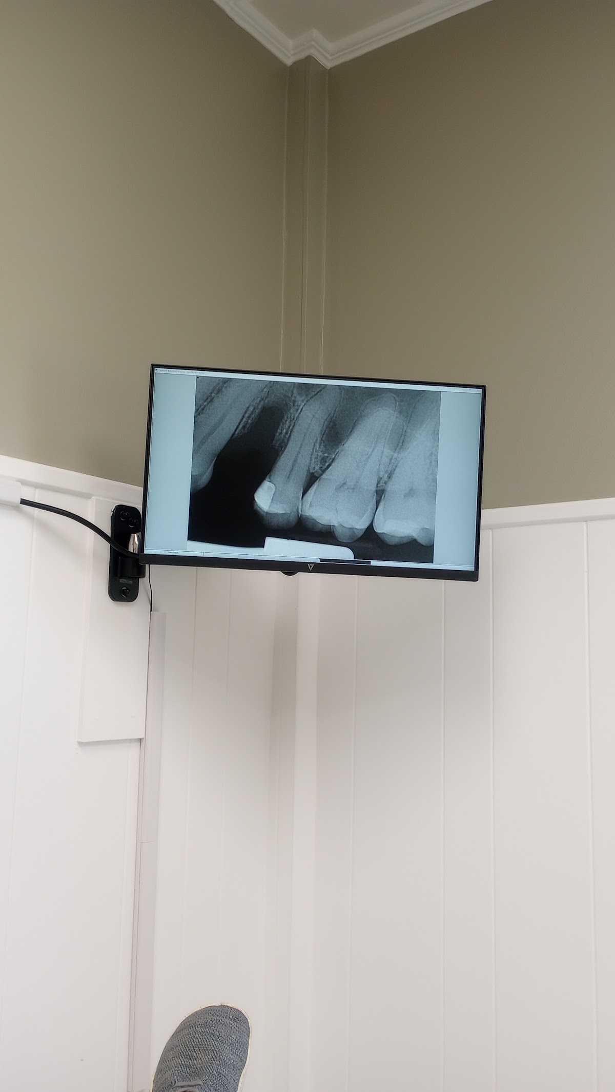 Aspen Dental - Thomaston photo 5