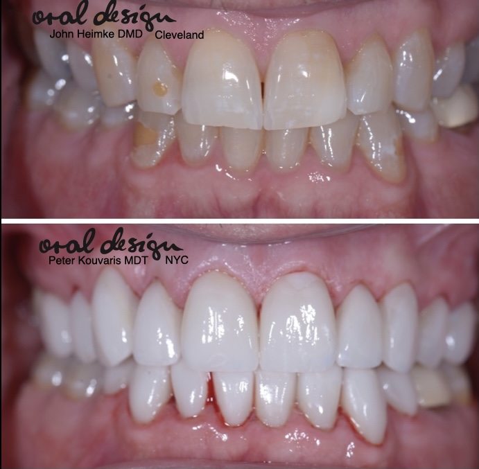Dental Implants Cleveland photo 1