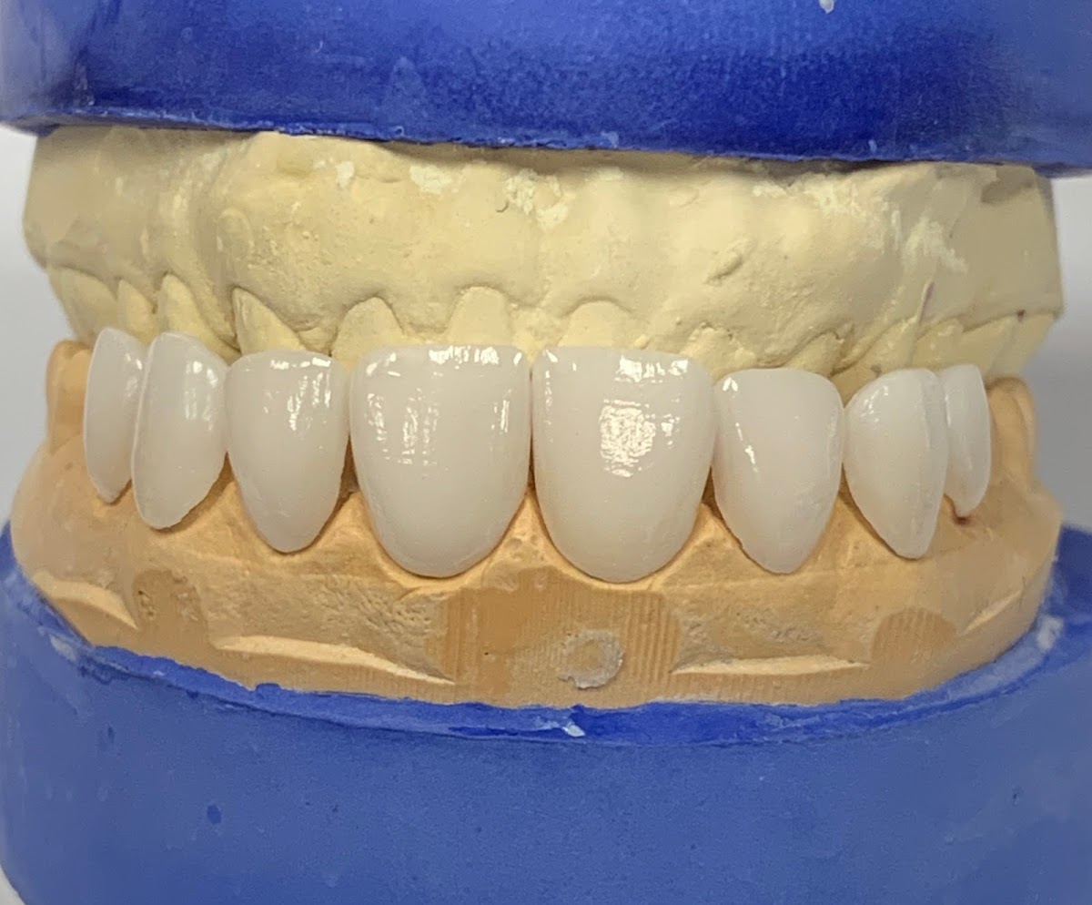 Dental Implants Cleveland photo 2