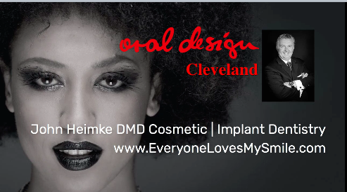 Dental Implants Cleveland photo 6