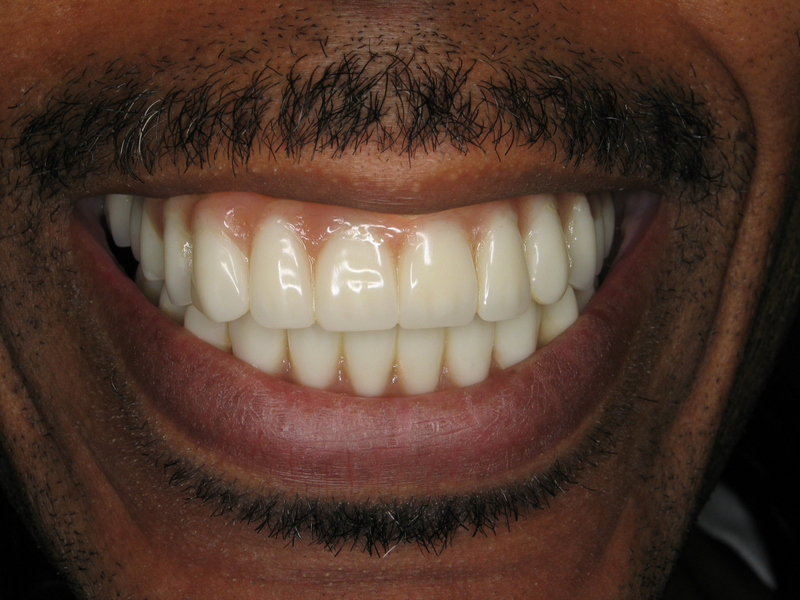 Teethnow Dental Implants New York City photo 4