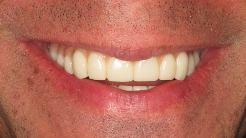 Teethnow Dental Implants New York City photo 5