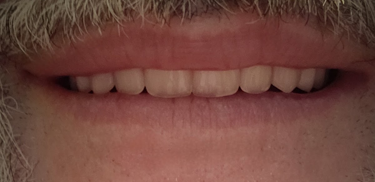 Affordable Dentures & Implants - Peoria photo 3
