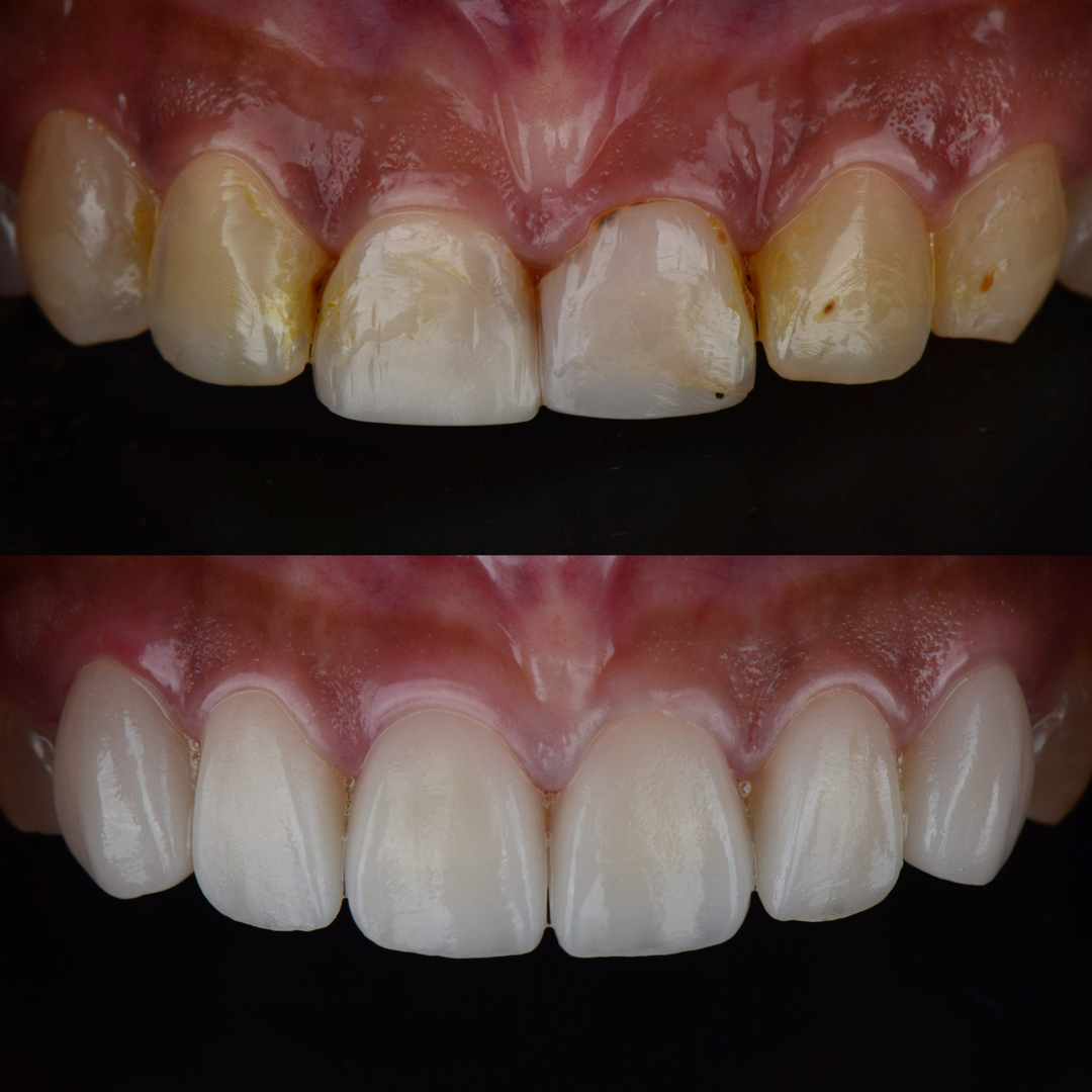 Jeppson Dental photo 1