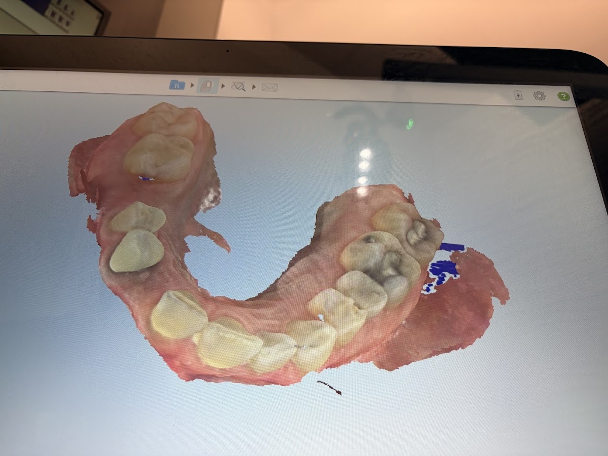 La Dental Clinic photo 5
