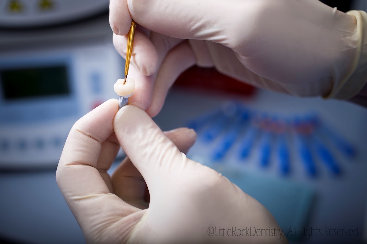 Little Rock Dentistry photo 6