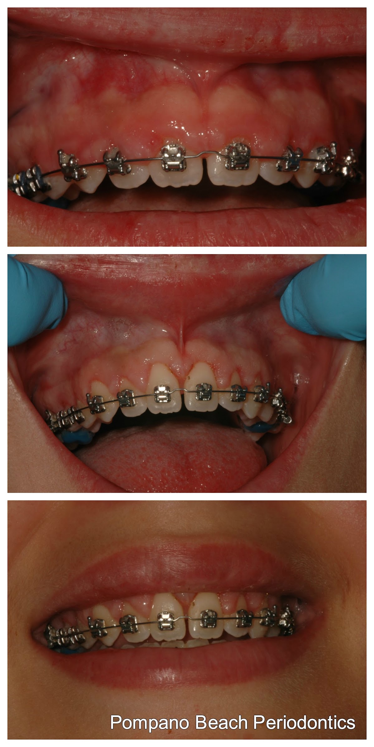Pompano Beach Periodontics photo 3