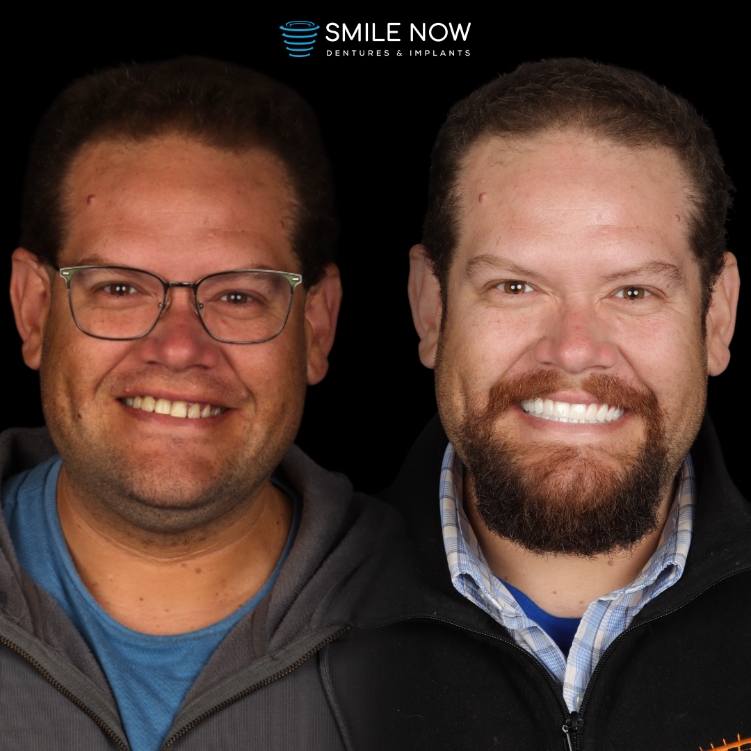 Smile Now Tri-cities Dentures and Implants photo 1