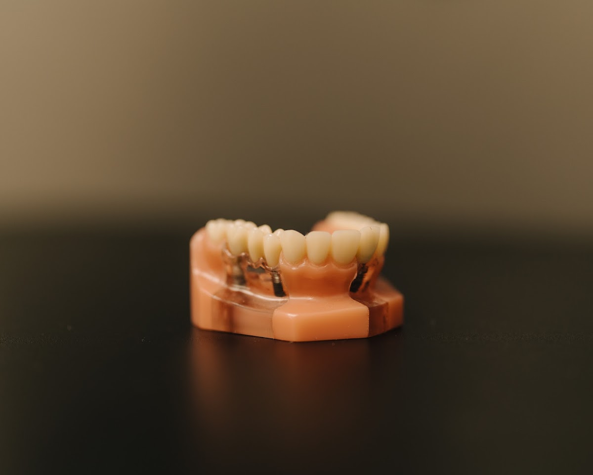 Smile Now Tri-cities Dentures and Implants photo 5