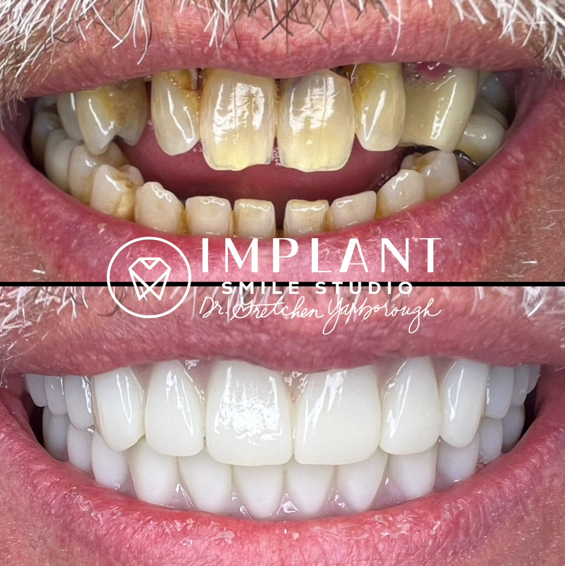 Implant Smile Studio photo 3