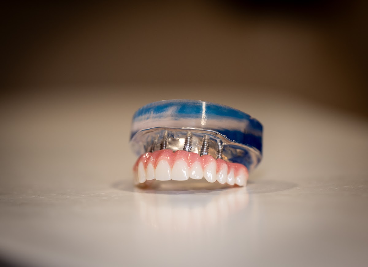 Implant Smile Studio photo 6