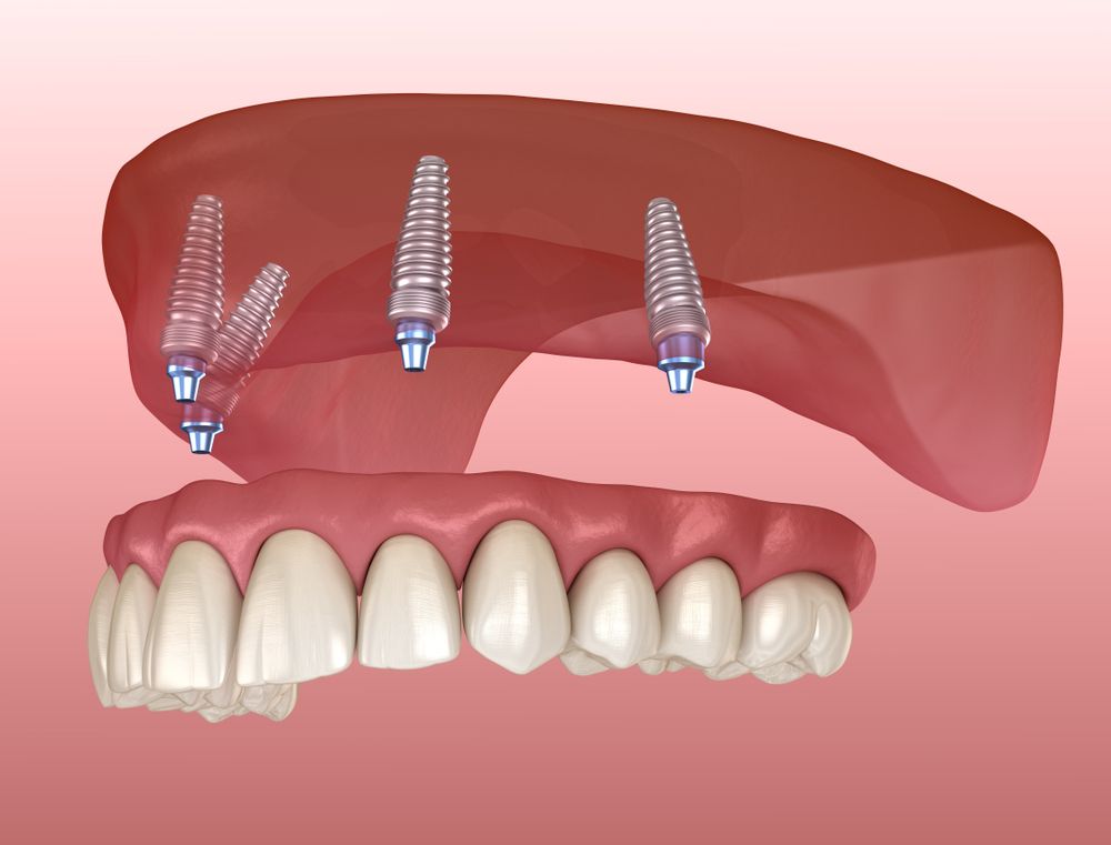 Central Coast Dental Care photo 6