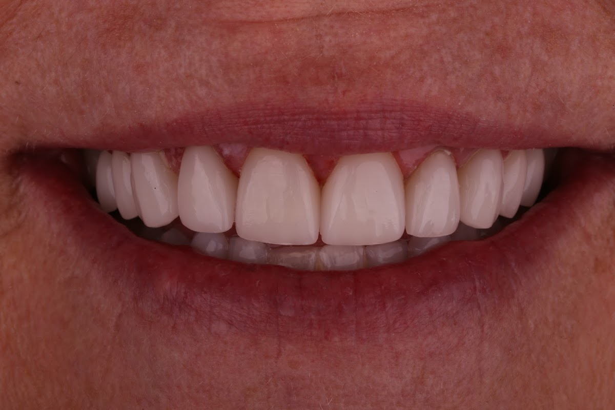 Volner Family Dental photo 6