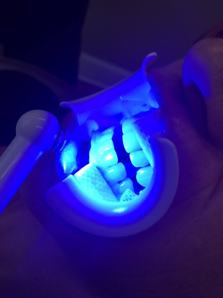 Sequoyah Dental Arts photo 6
