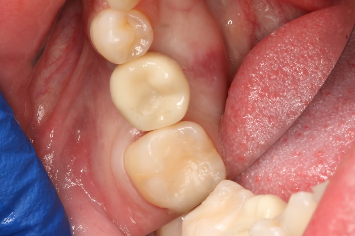 Concierge Dental Group Williamsville photo 6