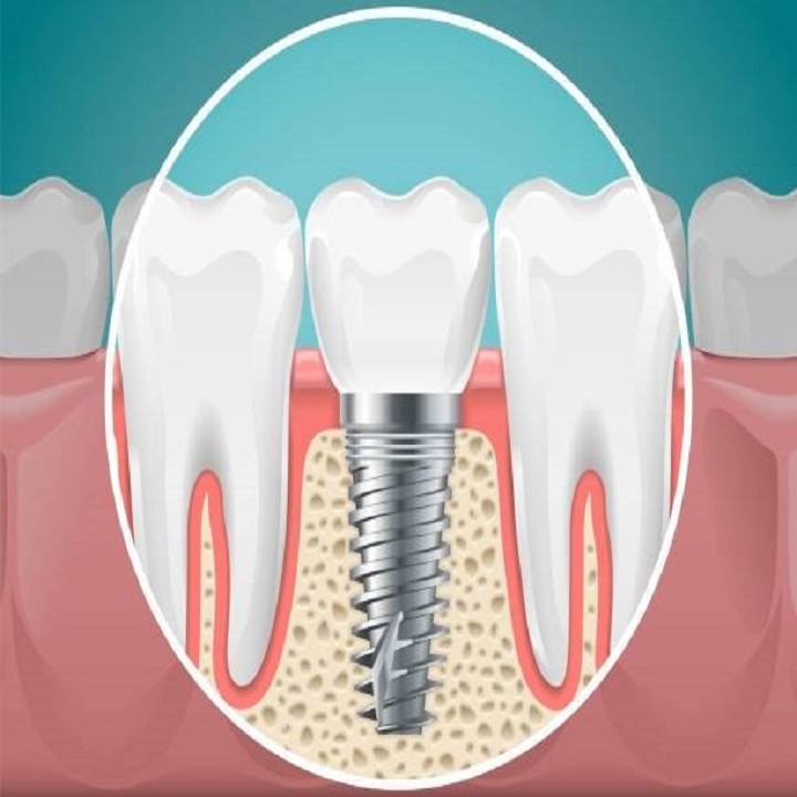 Bergens Periodontics & Implant Dentistry photo 5