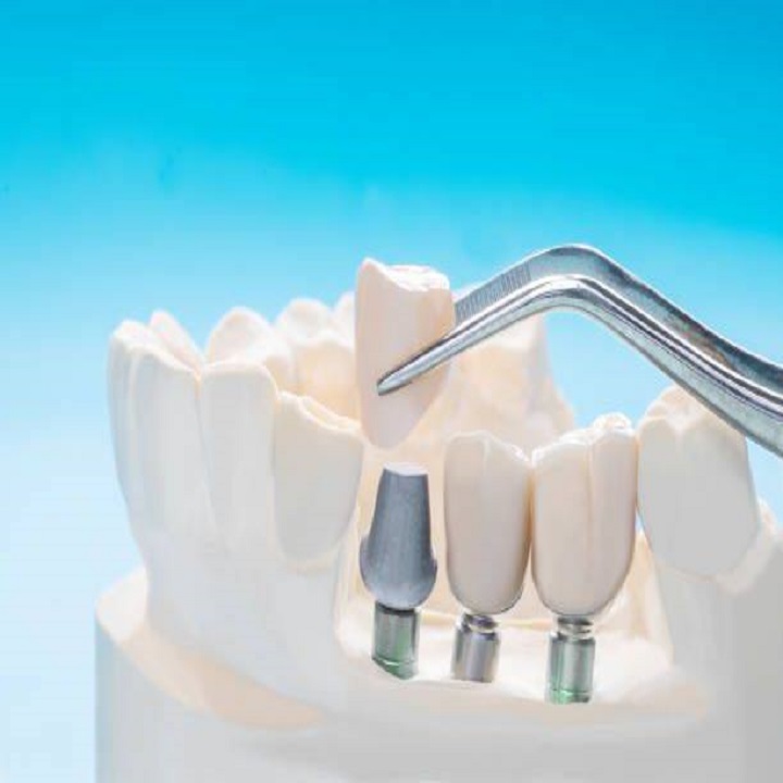 Bergens Periodontics & Implant Dentistry photo 6
