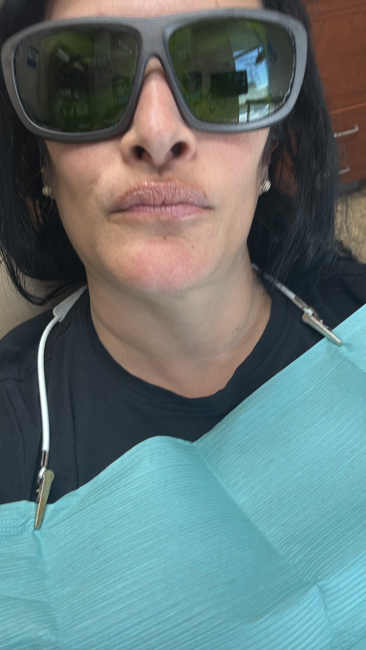 Aspen Dental - Smyrna photo 6