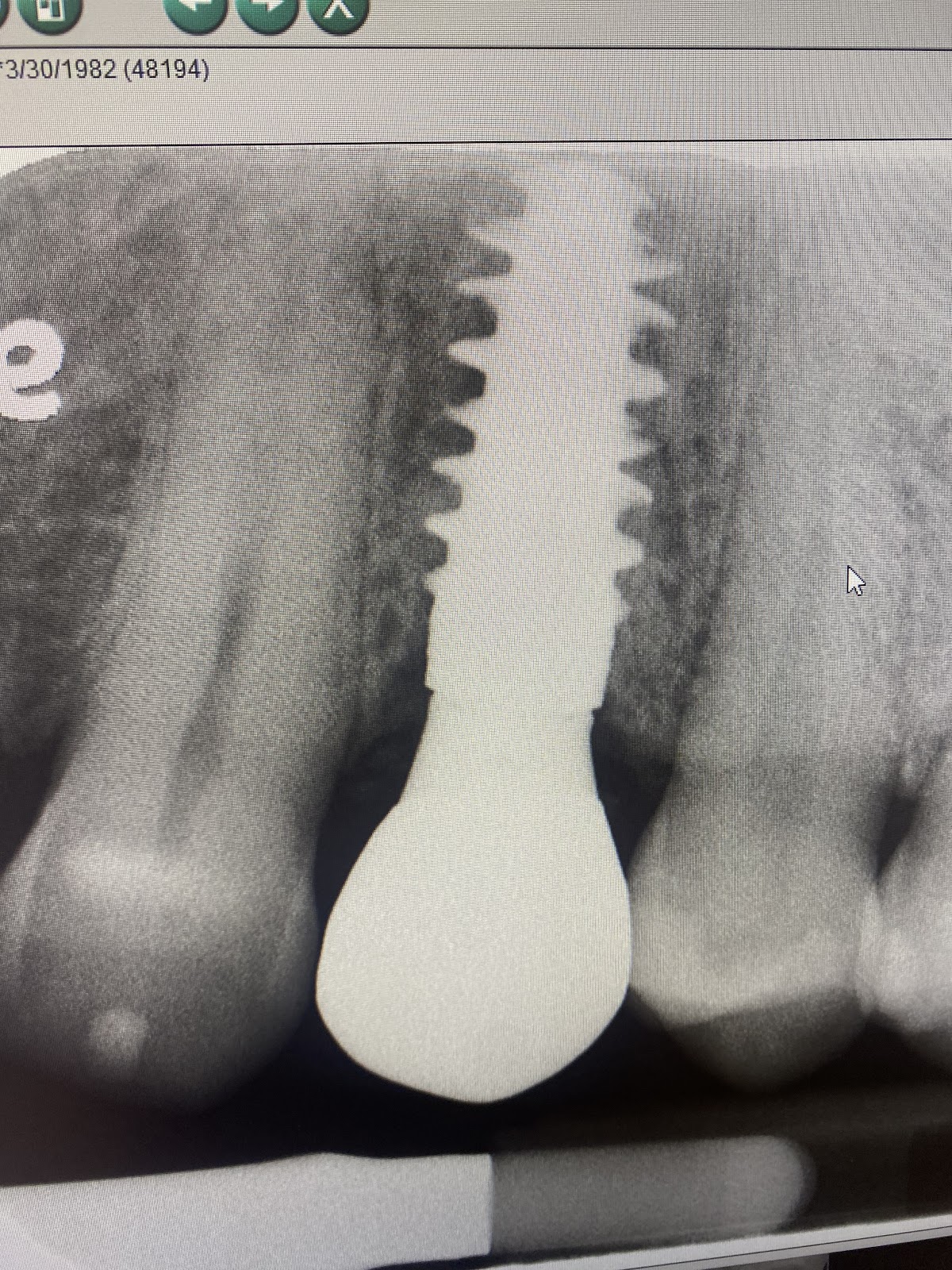 Implant & Periodontal Clinic: David a Baker DDS Msd photo 5