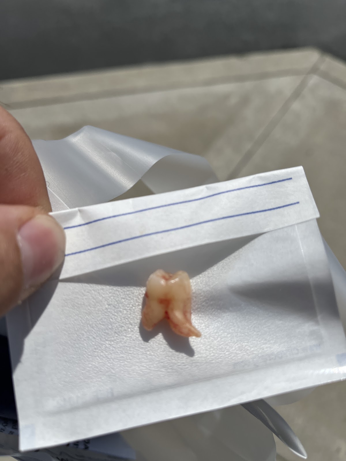 Implant & Periodontal Clinic: David a Baker DDS Msd photo 6
